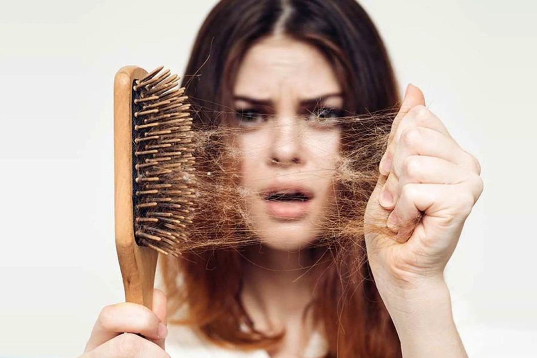 ریزش مو از کمبود آهن است یا استرس؟